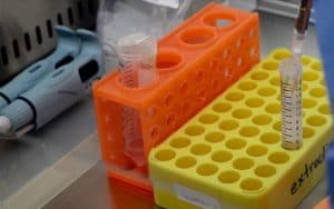 Διακοπή αποστολής δειγμάτων SARS-CoV-2 στο Εθνικό Κέντρο Αιμοδοσίας έως 8/9