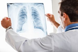 «‘Εξυπνο» σύστημα ανισχνεύει τον κοροναϊό με την βοήθεια της τεχνητής νοημοσύνης – Επικεφαλής Έλληνας της διασποράς
