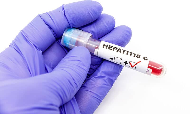 Σε τρεις επιστήμονες που ανακάλυψαν τον ιό της ηπατίτιδας C το Νόμπελ Ιατρικής
