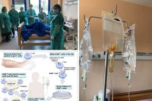 Θεραπεία CAR-T λεμφοκύτταρα στο Νοσοκομείο Γεώργιος Παπανικολάου