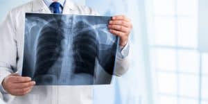 Χρόνια Αποφρακτική Πνευμονοπάθεια: O ρόλος της σπιρομέτρησης στην πρώιμη διάγνωσή της