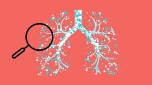 Dupilumab : Το αποτελεσματικό φάρμακο για το άσθμα