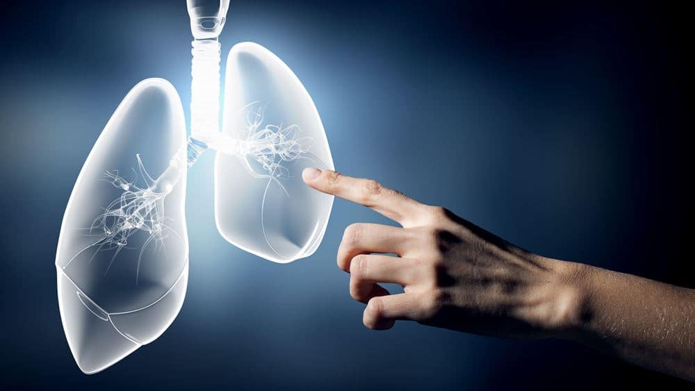 Έγκριση νέας θεραπείας για το μεταστατικό μη μικροκυτταρικό καρκίνο του πνεύμονα