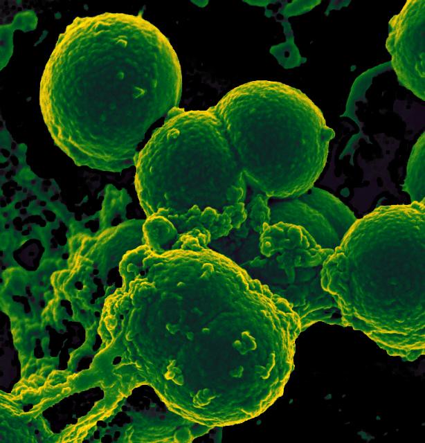 ναλλακτικές παρεμβάσεις για την πρόληψη λοιμώξεων σε προτεραιότητα λόγω ανθεκτικών μικροβίων
