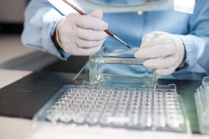 Ανοίγει η «ομπρέλα» των διαγνωστικών εξετάσεων που καλύπτονται από τον ΕΟΠΥΥ